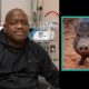 First Person To Receive A Genetically Modified Pig Kidney Transplant Dies 2 Months Later